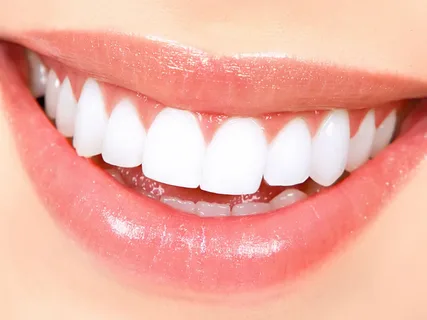 فروش دندان متحرک ژله‌ای با قیمت استثنایی و کیفیت بالا